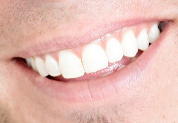 Family Dentist Scarborough